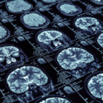 Image of brain scans